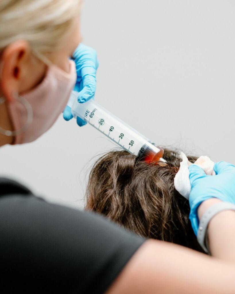 PRP Hair Loss Injection 